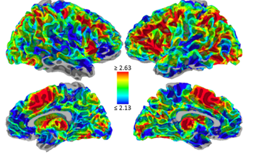 Pessoa brain image